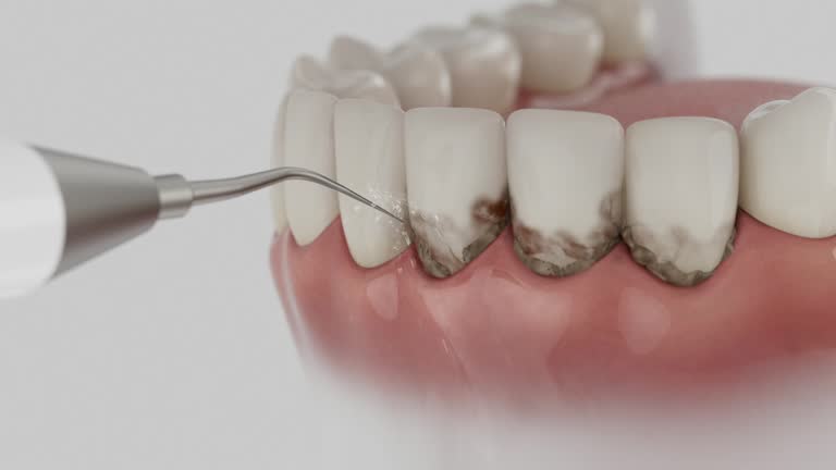 Reliable Dental Implants contractor in Dayton, NJ by Smile Center Dentistry